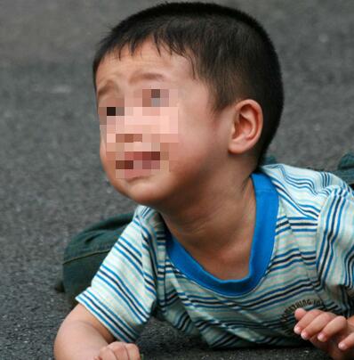 小孩癫痫频繁发作怎么办
