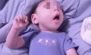 癫痫发作用经颅磁刺激仪能治愈吗